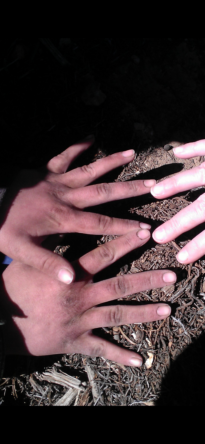 Campers hands during the winter months when they would forgo baths in an attempt to stay warm.