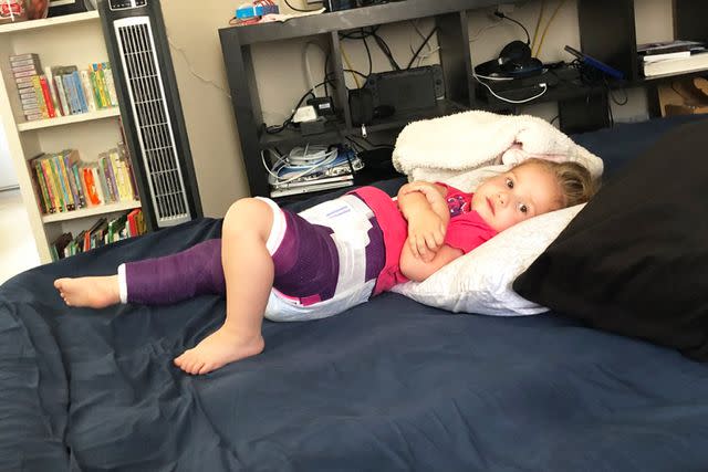<p>Amelia Zamora</p> Zamora's daughter laying in her cast.