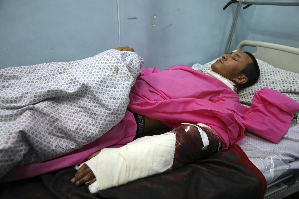 A man is treated at a hospital after a deadly attack at Kabul University, in Kabul, Afghanistan, Monday, Nov. 2, 2020. The brazen attack by gunmen who stormed the university has left many dead and wounded in the Afghan capital. The assault sparked a hours-long gunbattle. (AP Photo/Rahmat Gul)