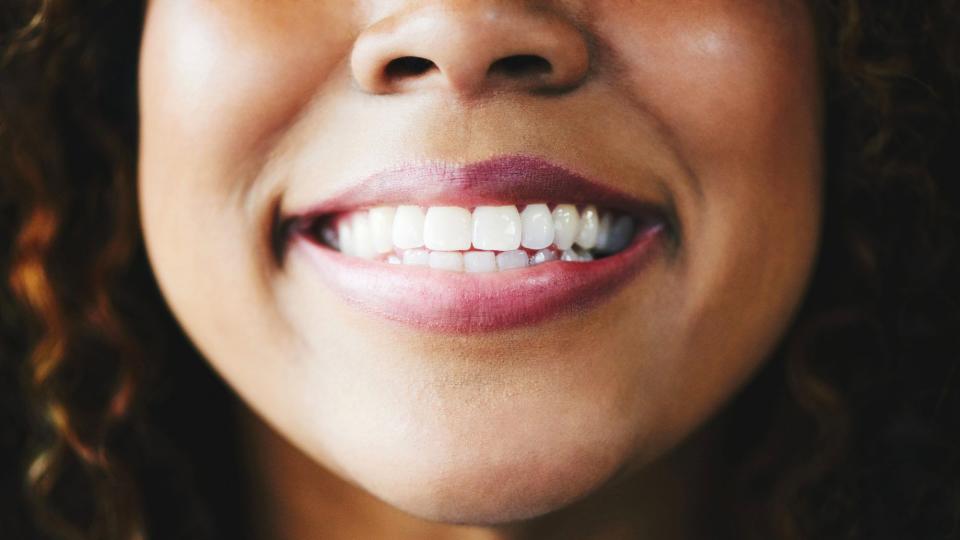 Photo of a dark-skinned person smiling with whitened teeth