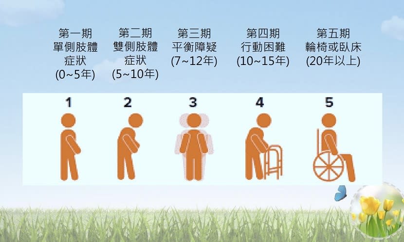 巴金森氏症-病程-分期-症狀-治療