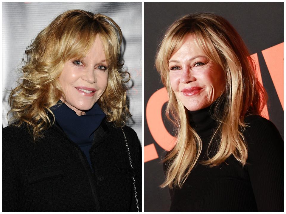 Melanie Griffith said she spent years having her cosmetic work reversed.