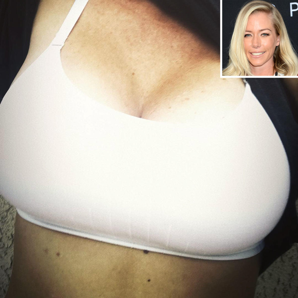 Kendra Wilkinson Defends Her Breast Implants I Couldn T Care Less What A Man Thinks