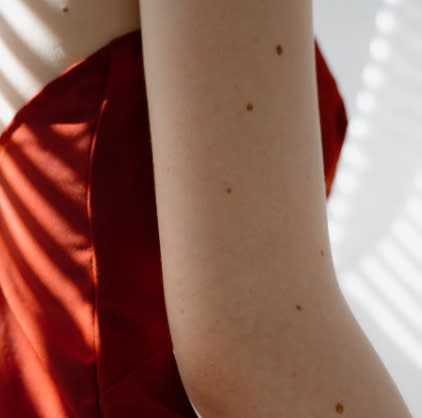 皮膚白的人罹患皮膚癌的風險會比較高。（示意圖／翻攝自pixabay）