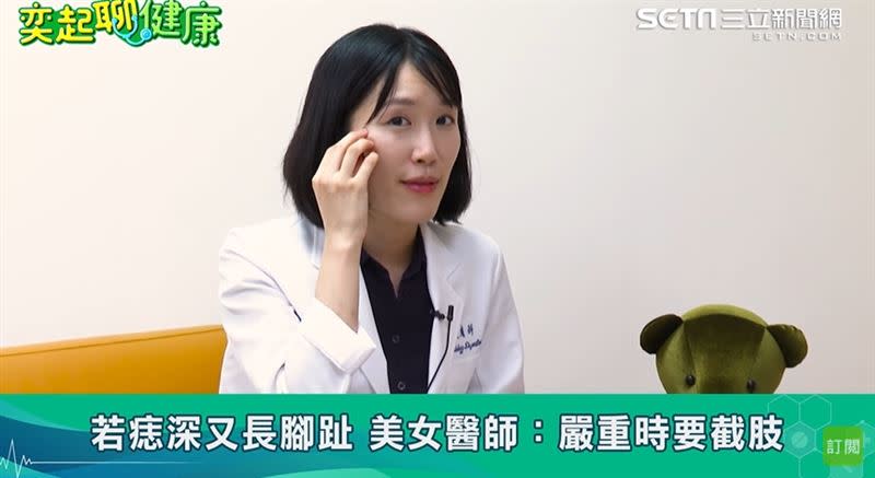  倪匡皮膚癌過世，王筱涵醫師警告7種人小心。 （圖／節目提供）