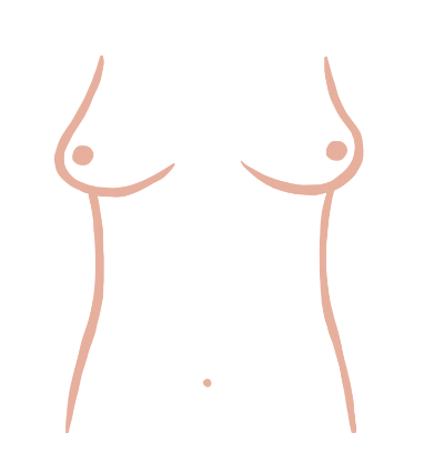 Doctors Explain What You Need to Know About Your Breasts' Shape
