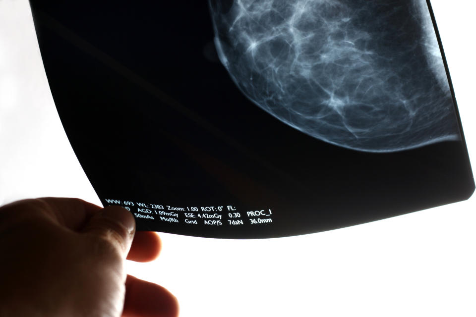 Why did experts lower the recommended age for women to begin getting mammograms?