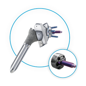 RevoMotion™ Reverse Shoulder System showing smallest diameter threaded glenoid baseplate