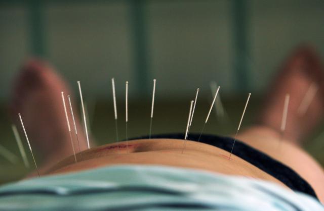 Does acupuncture work for menstrual cramps? We tried it and talked