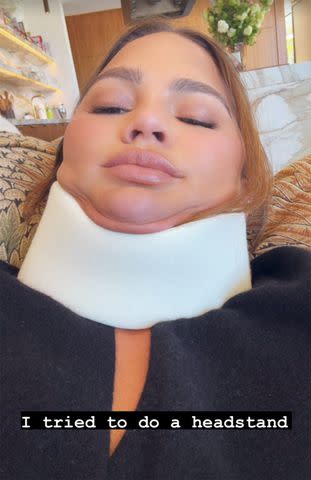 <p>Chrissy Teigen/Instagram</p> Chrissy Teigen in a neck brace in an Instagram Stories post on May 6