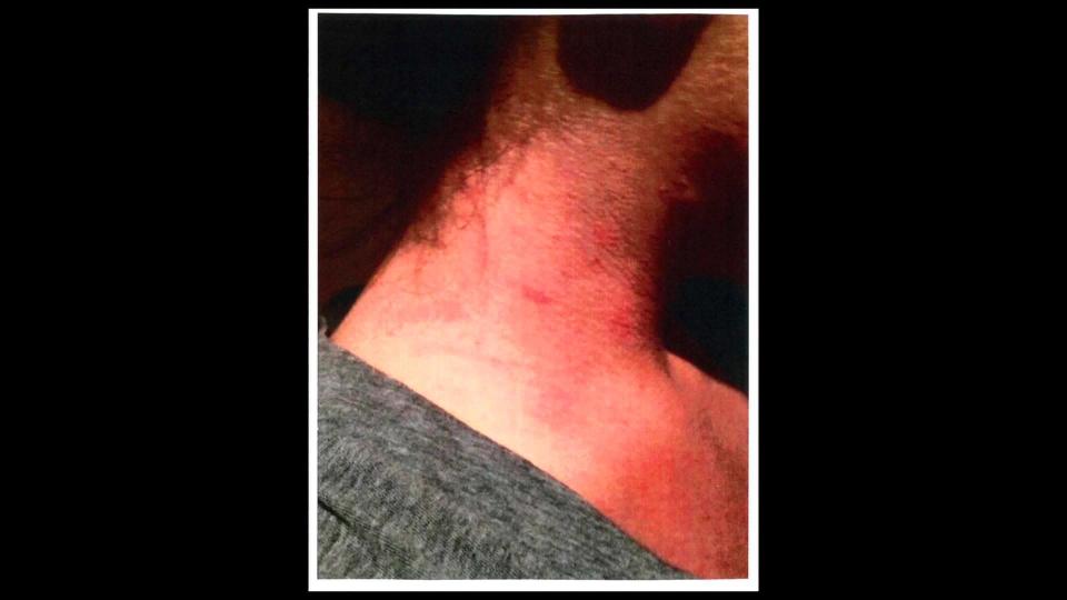 Chelsea DiMaio says she took photos which show what appears to be hand marks on Diana's neck.  / Credit: Florida State Attorney's Office, 19th Circuit