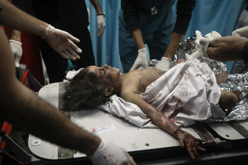 A Palestinian child wounded in the Israeli bombardment of the Gaza Strip receives treatment at the Nasser hospital in Khan Younis, Southern Gaza Strip, Sunday, Dec. 31, 2023. (AP Photo/Mohammed Dahman)