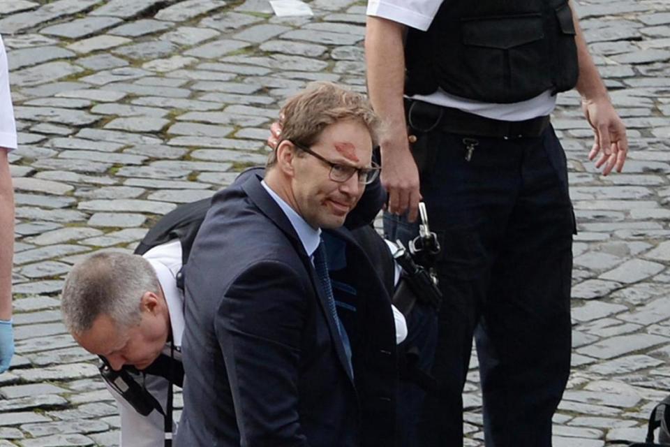 Bloodied: Tobias Ellwood (PA)