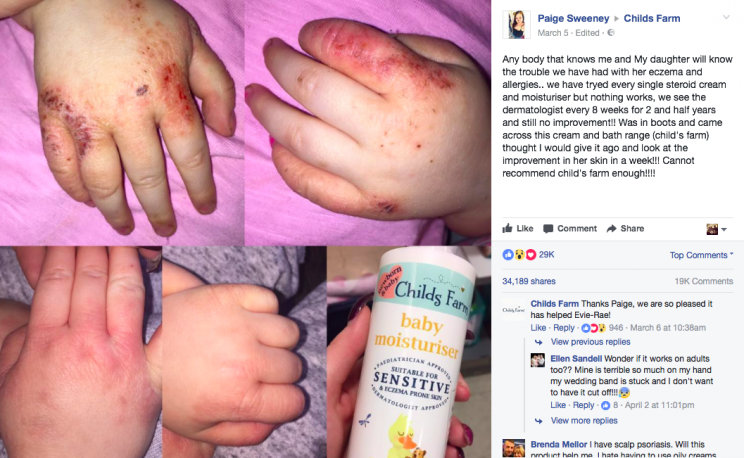 Paige Sweeney took to the Childs Farm Facebook to show the results of using the cream [Photo: Facebook/Paige Sweeney]