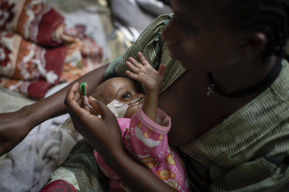 Birhan Etsana, 27, from Dengelat, uses a nasogastric tube to feed her malnourished baby, Mebrhit, who at 17 months old weighs just 5.2 kilograms (11 pounds and 7 ounces), at the Ayder Referral Hospital in Mekele, in the Tigray region of northern Ethiopia, on Monday, May 10, 2021. The lone survivor of her triplets, the infant was admitted with complications stemming from severe acute malnutrition, including heart failure. (AP Photo/Ben Curtis)