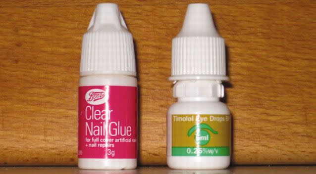 The man confused the nail glue, similar to superglue, with the eye drops. Photo: BMJ