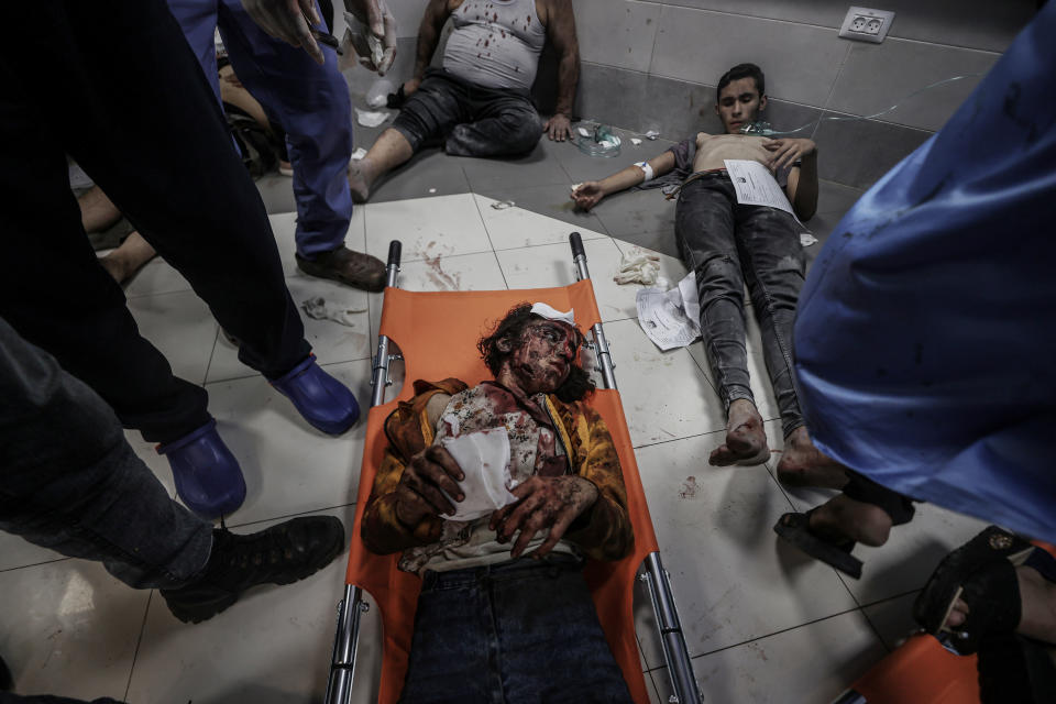 10 月 17 日加沙阿赫利阿拉伯醫被轟炸，傷者被送到附近的希法醫院（Al-Shifa Hospital），有傷者躺在地上等候救援。 (Photo by Ali Jadallah/Anadolu via Getty Images)