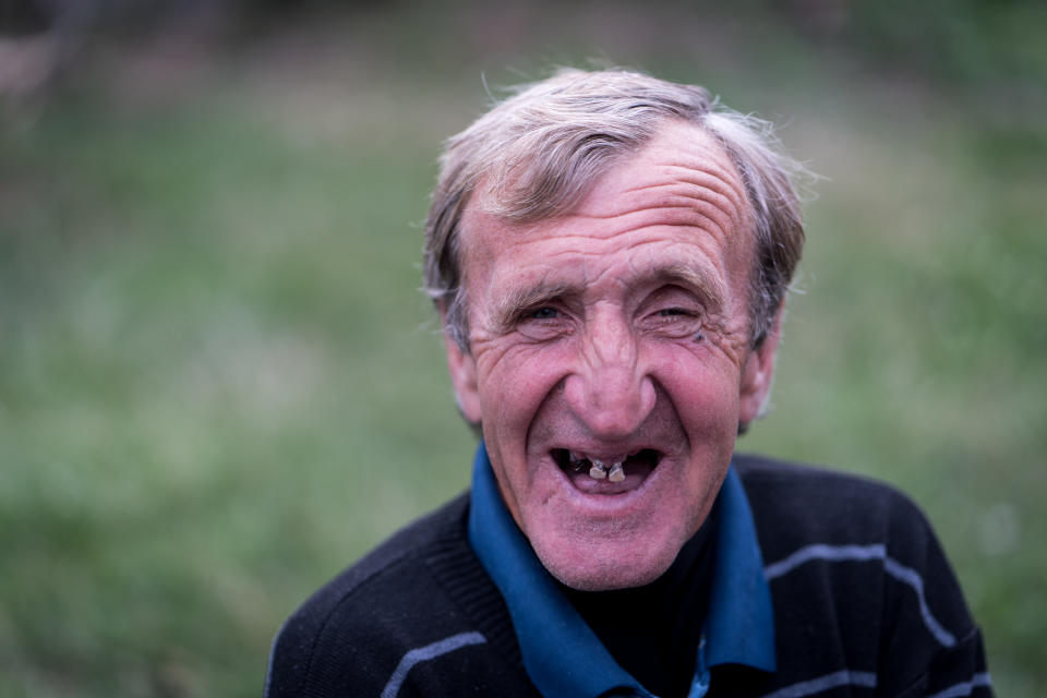 La acción de masticar con deficiencia por la pérdida de dientes también puede afectar las capacidades cognitivas de las personas mayores. (Getty Creative)