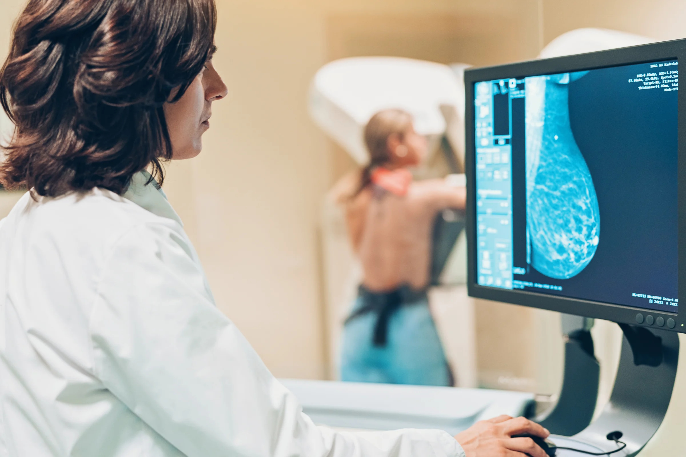 Doctor and patient making a mammography. Canada federally recommends starting routine mammograms at 50, but access differs by province. 