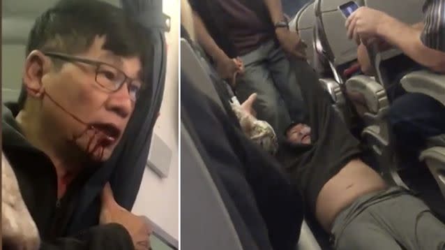 Dr David Dao was dragged from a United Airlines flight and allegedly left bloodied in the process. Source: Twitter