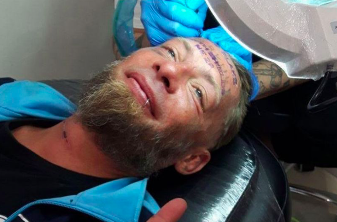 <em>Homeless man Tomek claimed he was a paid £89 by a British stag group to have the groom’s name tattooed on his forehead (Facebook)</em>