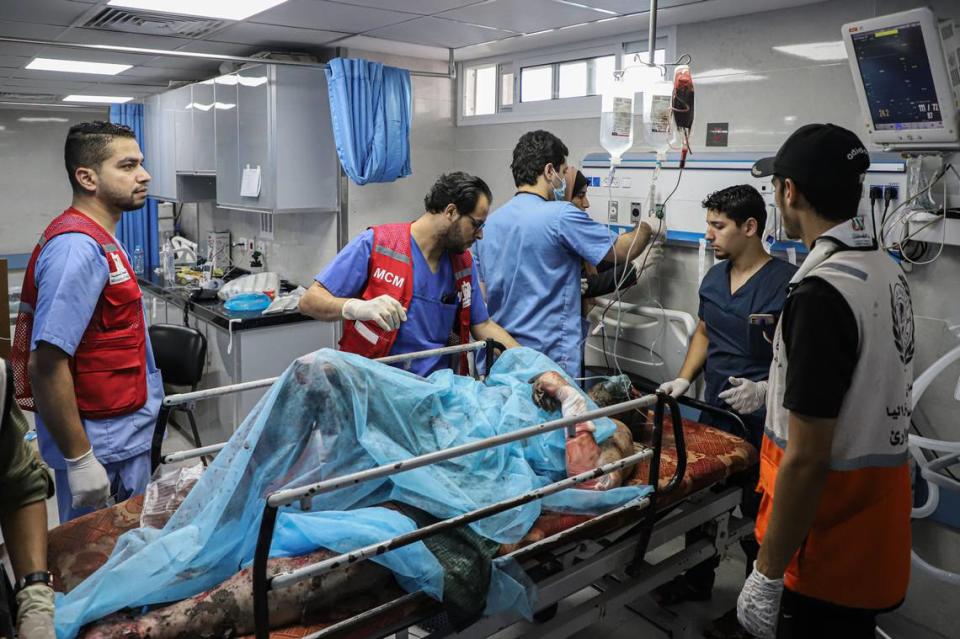 Un hombre herido recibe tratamiento médico en un hospital en Ciudad Gaza, el martes 17 de octubre de 2023.