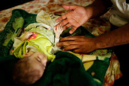 A nurse touches the hand of patient Iraqi girl Nawras Raed, six month, at a hospital run by Medecins Sans Frontieres in Qayyara, Iraq April 6, 2017. REUTERS/Suhaib Salem