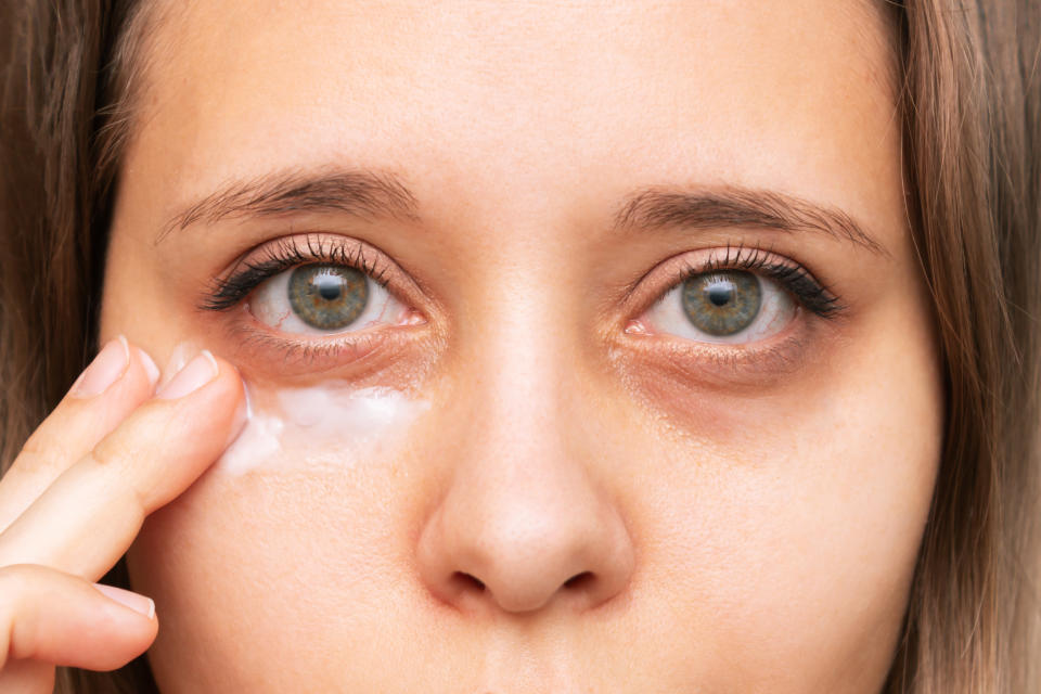 Woman putting eye cream on her tired eyes. (Getty Images)