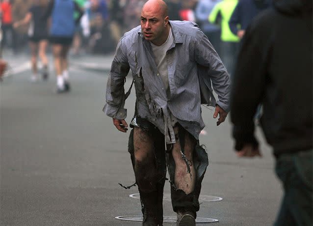 A photograph of Costello with his clothes ripped to shreds and parts of his body burned became one of the most recognised images of the 2013 attack. Photo: AP