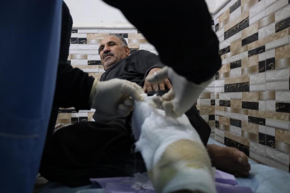 PHOTO: A doctor changes a bandage on farmer Anwar Al-Halabi, who says he was injured as a result of being hit by a guided missile, on March 17, 2024, Al-Rahma Hospital in the city of Darkush, west of Idlib, Syria. (Abdul Razzaq Al-Shami/ABC News)