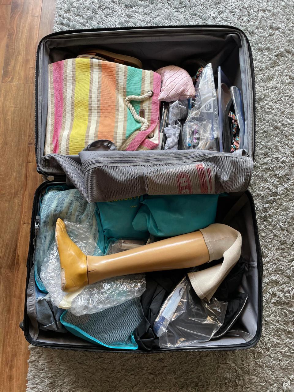 Emily Tuite packed her custom prosthetic leg in a blue suitcase for her trip to San Diego.