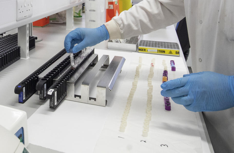 Clinical support technician Douglas Condie extracts viruses from swab samples so that the genetic structure of a virus can be analysed and identified in the coronavirus testing laboratory at Glasgow Royal Infirmary.