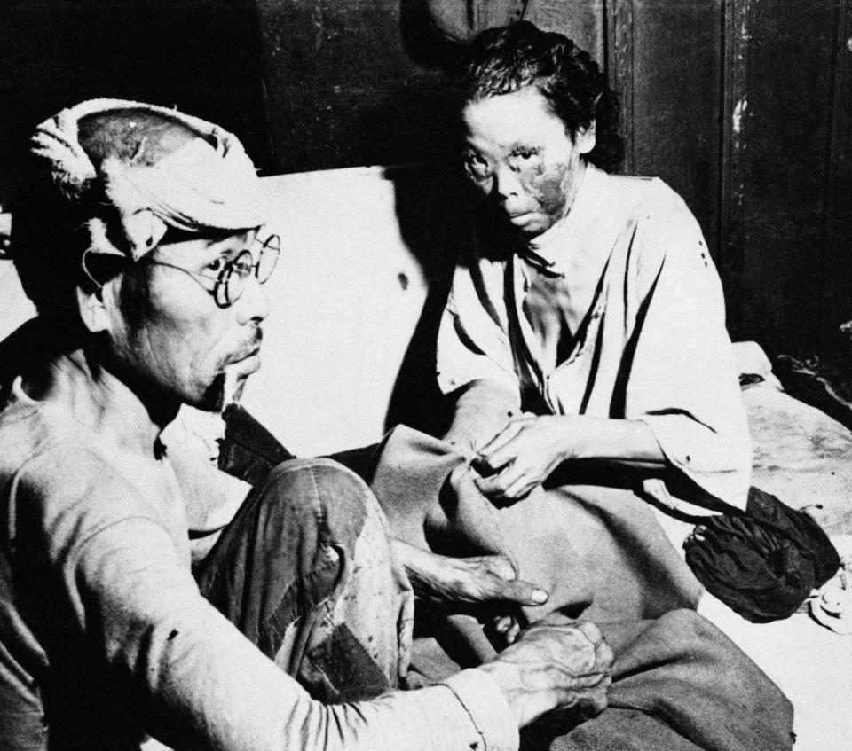 Dos japoneses heridos por severas quemaduras por el bombardeo atómico de Hiroshima esperan en un hospital japonés. (AP Photo)