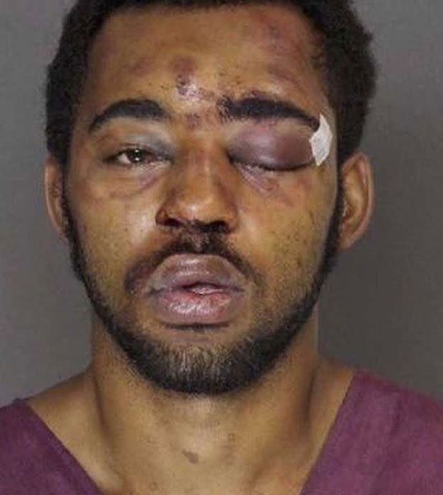 It's understood that nobody was injured during the robbery, but the mugshot indicates that McCoy may have suffered some sort of injury during the arrest. Source: NBC