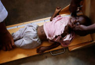 A severely acute malnourished and internally displaced Congolese child is screened at the Tshiamala general referral hospital of Mwene Ditu in Kasai Oriental Province in the Democratic Republic of Congo, March 15, 2018. Picture taken March 15, 2018. REUTERS/Thomas Mukoya