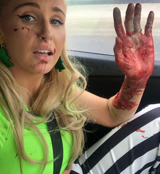 Annie Nolan is pictured with her hand covered in blood. Source: Instagram 