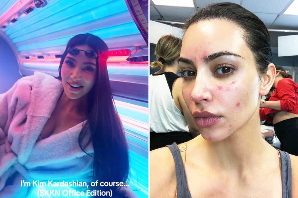 <p>Kim Kardashian/TikTok; Kim Kardashian/Instagram</p> Kim Kardashian has a tanning bed in her office and says she uses it for psoriasis flares.