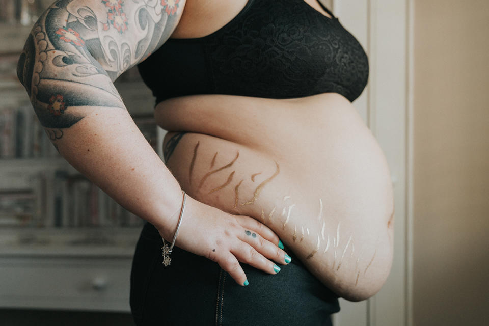 Stretch marks dipped in gold. (Photo: Grace Elizabeth Photography)