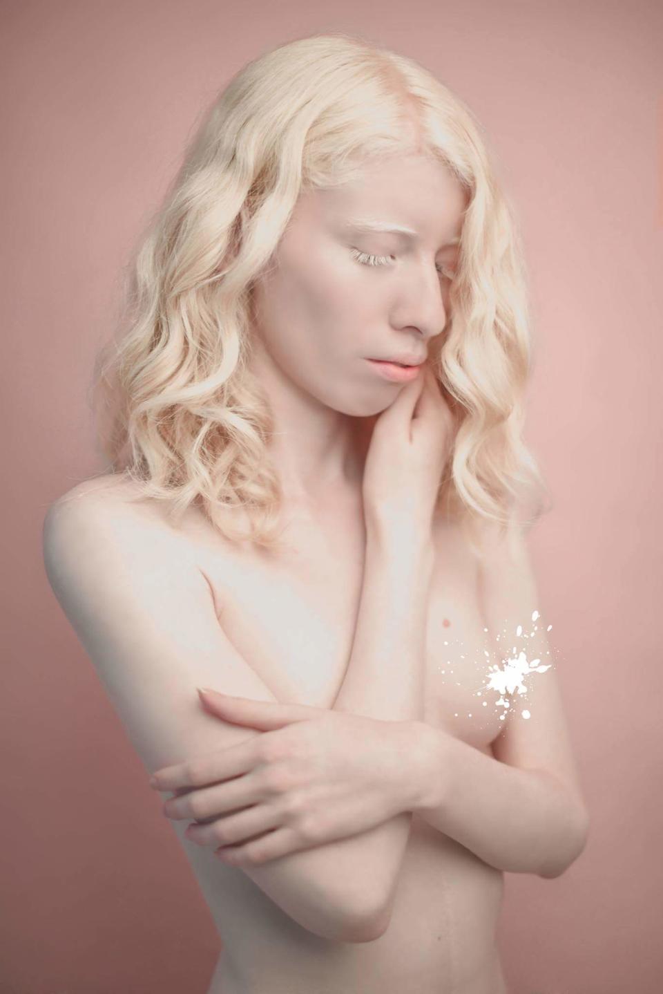 Mexican model Ruby Vizcarra is empowering other albinos to love being different. (Photo: Courtesy of Ruby Vizcarra)