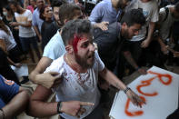 FILE - In this July 13, 2021 file photo, a relative of someone who was killed in last year's massive blast at Beirut's seaport bleeds during clashes with riot police as he and others try to storm the home of then caretaker Interior Minister Mohamed Fehmi, in Beirut, Lebanon. For eight months Tarek Bitar, a relatively obscure judge has quietly investigated one of the world's worst non-nuclear explosions with only two assistants helping him -- and a lot of powerful detractors blocking him. For many Lebanese Bitar is their only hope for truth and accountability in a country that craves both. But for the country's entrenched political class, the 47-year-old Bitar has become a nightmare that needs to be dealt with. (AP Photo/Bilal Hussein)