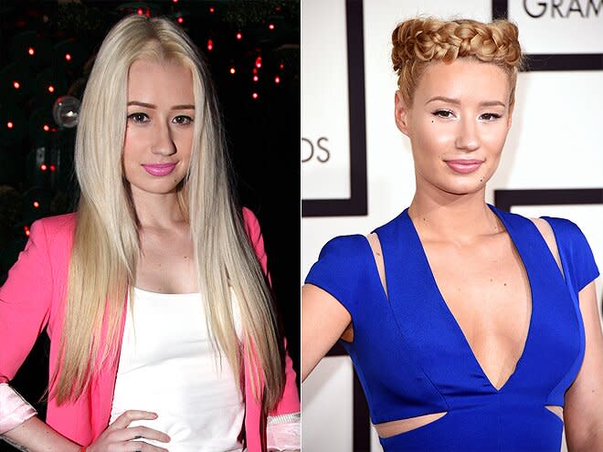 “It s hard to be a woman in 2015 with social media … There's a lot more pressure to look beautiful,” the rapper <a href="http://www.stylenews.peoplestylewatch.com/2015/08/04/iggy-azalea-admits-to-nose-job/" rel="nofollow noopener" target="_blank" data-ylk="slk:told Seventeen;elm:context_link;itc:0;sec:content-canvas" class="link ">told <em>Seventeen</em></a> about her decision to get a nose job, shortly after admitting to <em>Vogue</em> she’d <a href="http://stylenews.peoplestylewatch.com/2015/03/24/iggy-azalea-breast-implants-vogue-interview/" rel="nofollow noopener" target="_blank" data-ylk="slk:gotten breast implants;elm:context_link;itc:0;sec:content-canvas" class="link ">gotten breast implants</a>. But her number one rule for cosmetic surgery: come clean. “I’m not denying it. Denying it is lame,” she said.