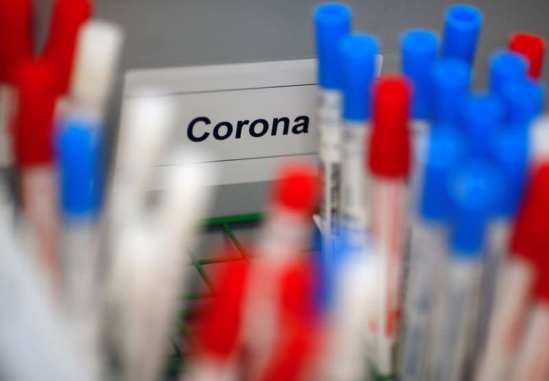 Plastic vials containing tests for the coronavirus are pictured at a medical laboratory