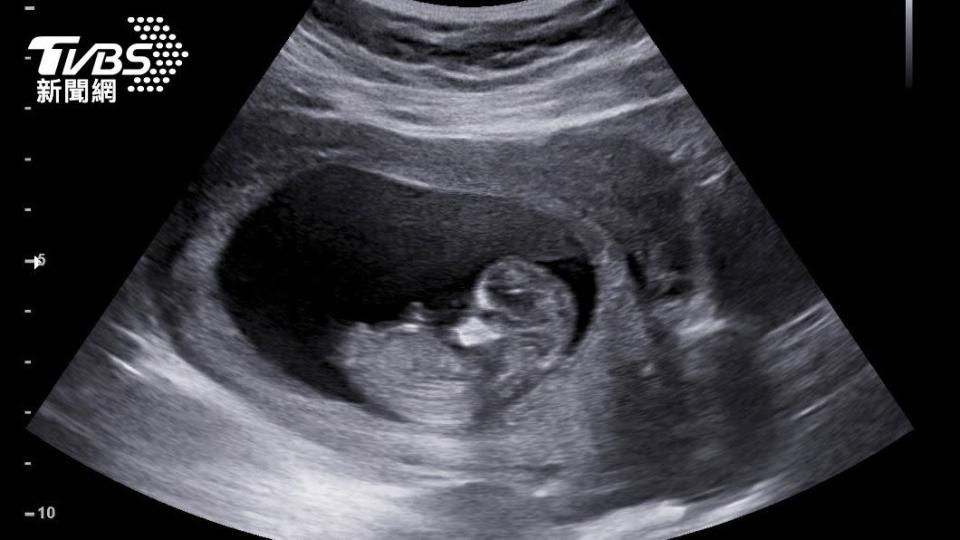 三寶媽月經沒來，經超音波檢查才發現懷孕。（示意圖／shutterstock達志影像）