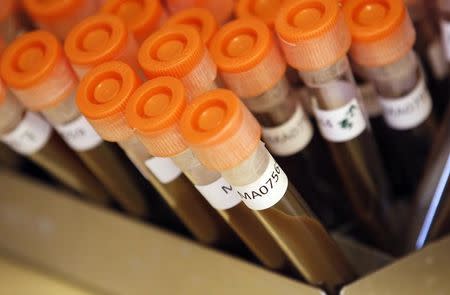 Test tubes filled with samples of bacteria to be tested are seen at the Health Protection Agency in north London March 9, 2011. REUTERS/Suzanne Plunkett