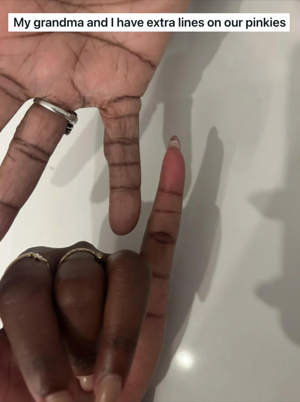 person and their grandma's pinky fingers with extra creases