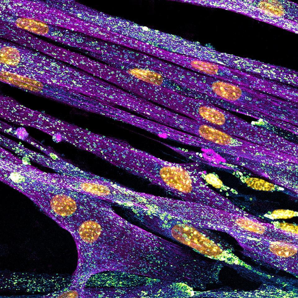 Differentiated cultured mouse myoblasts with lysosomes (cyan/green), nuclei (yellow), F-actin (magenta)