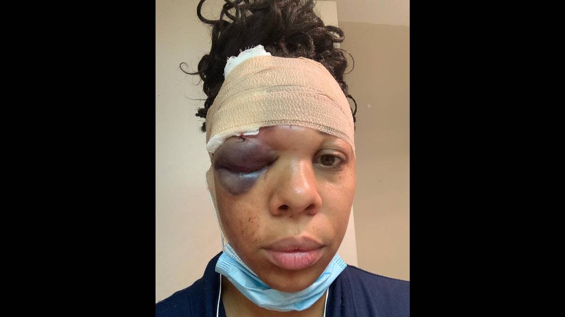 Latoya Ratlieff, in the aftermath of being struck in the eye.