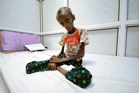 Saida Ahmad Baghili, 18, who is affected by severe acute malnutrition, sits on a bed at the al-Thawra hospital in the Red Sea port city of Houdieda, Yemen October 24, 2016. REUTERS/Abduljabbar Zeyad