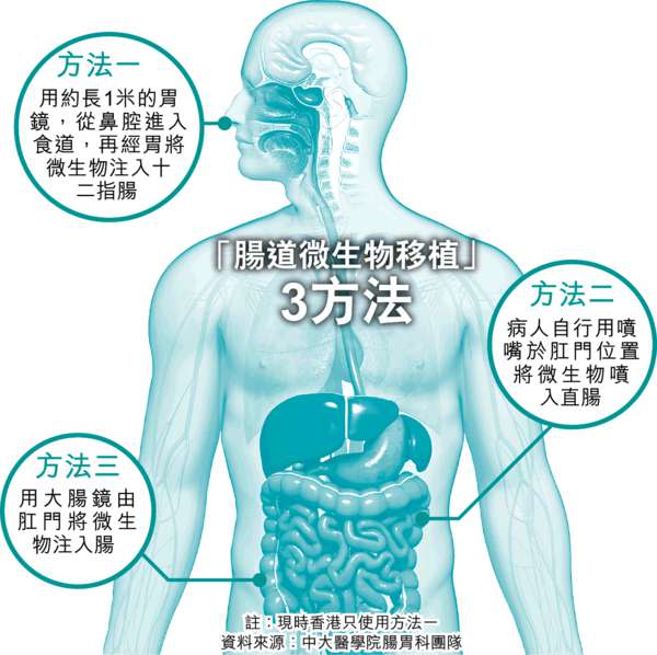 中大奇招 糞便治腸病 半日見效