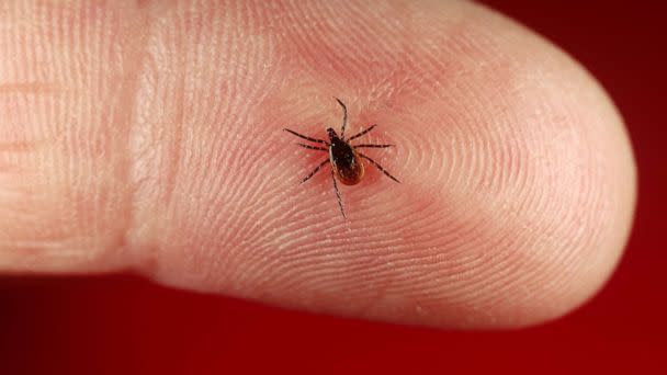 PHOTO: An undated photo of a deer tick. (STOCK PHOTO/Getty Images)